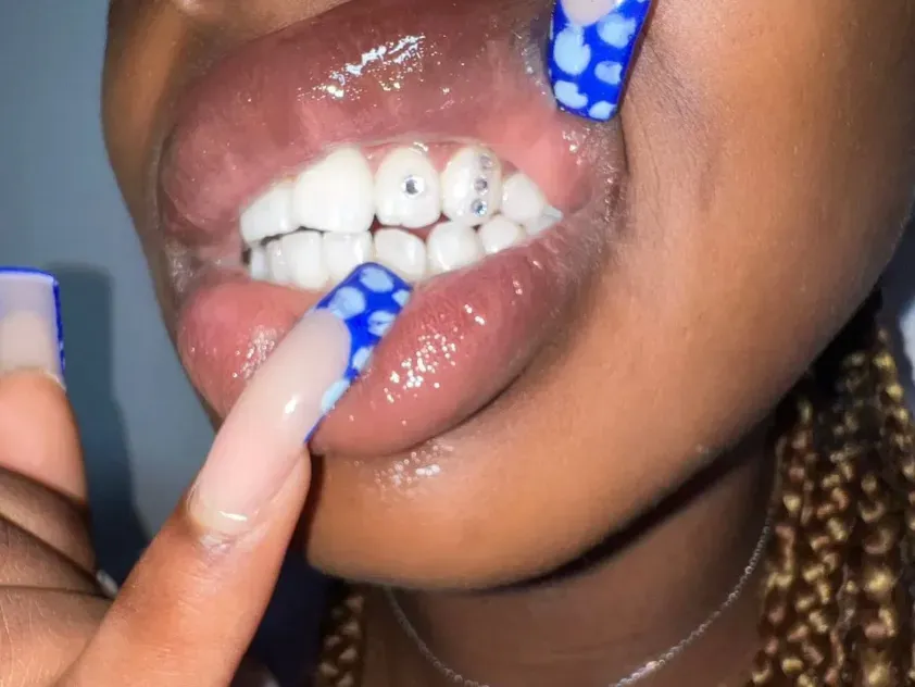 strass-dentaires (4)