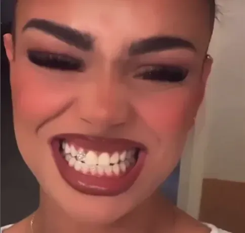 strass-dentaires (1)