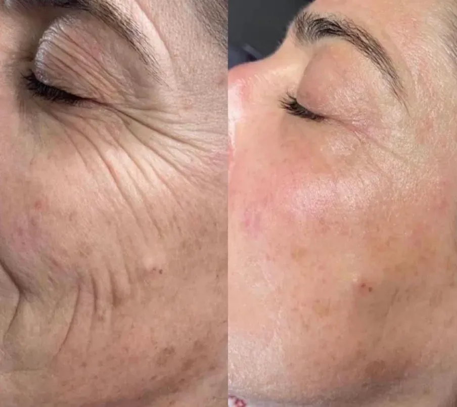 Soins du visage et soins corporels à Villeurbanne 