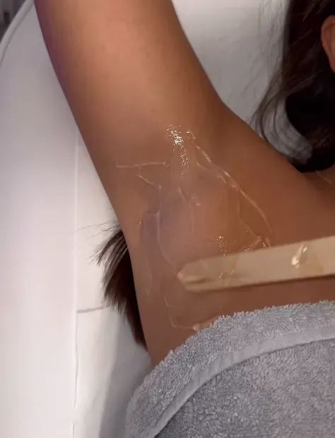 epilation-definitive (5)