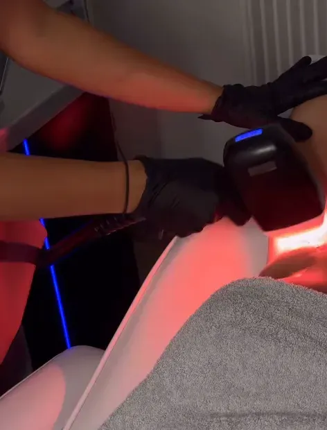 epilation-definitive (2)