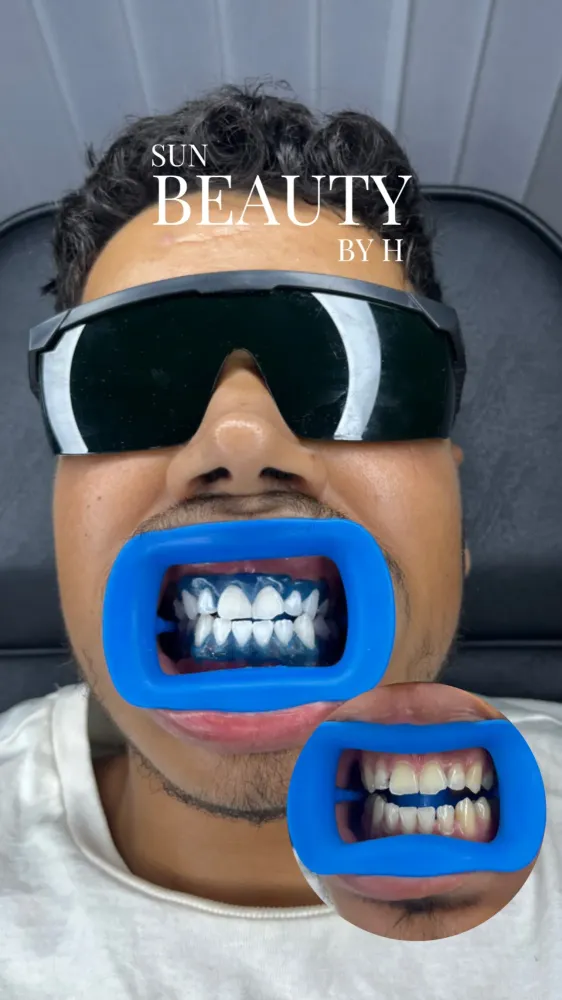 spécialiste du sourirewebp